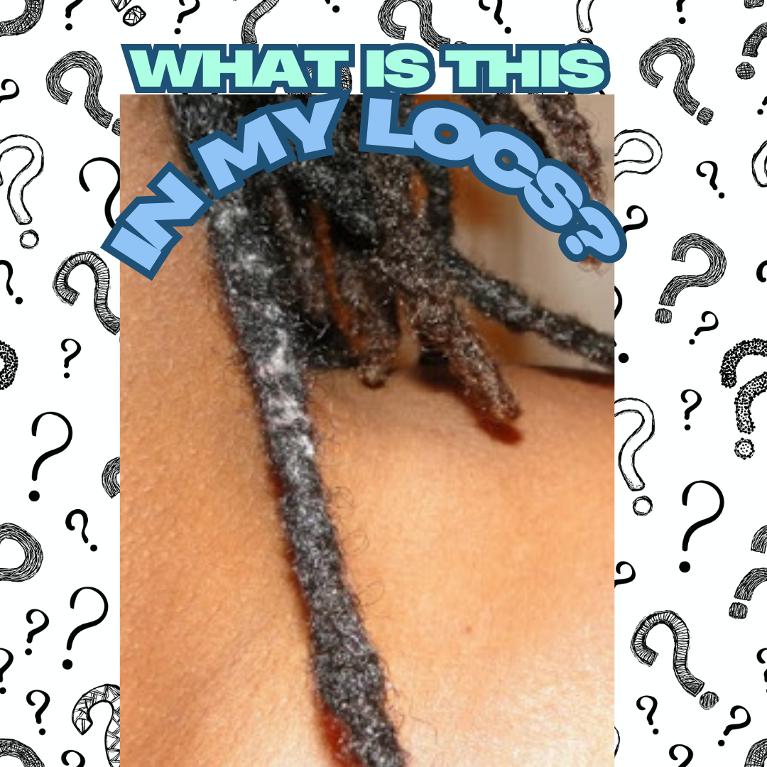 It's not lint in your locs, it's...